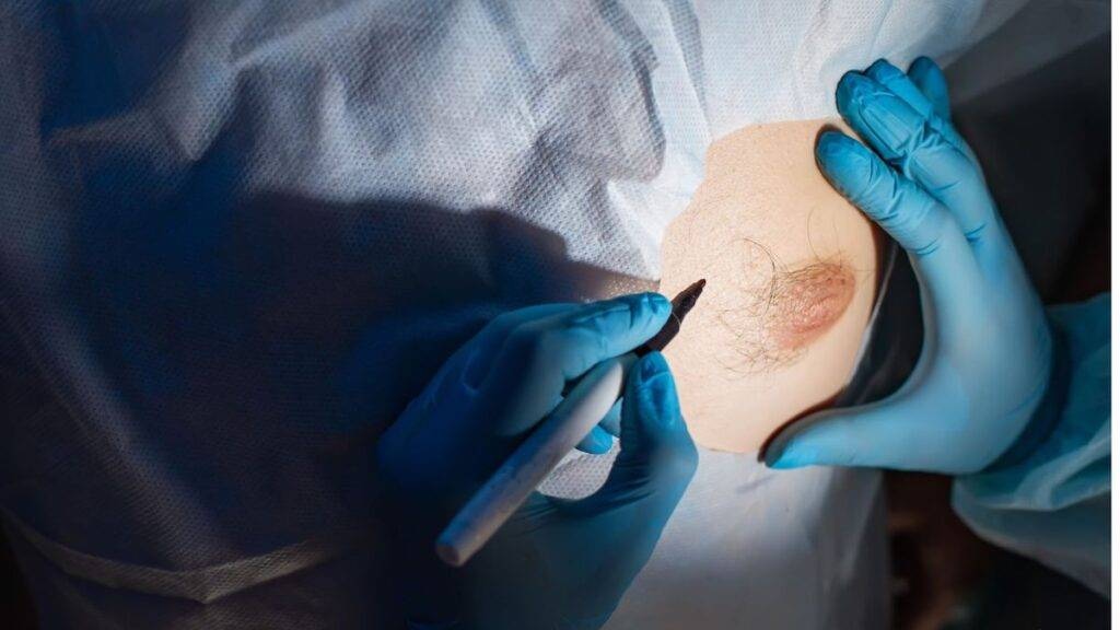 Bruststraffung für die moderne Frau: Ein Leitfaden